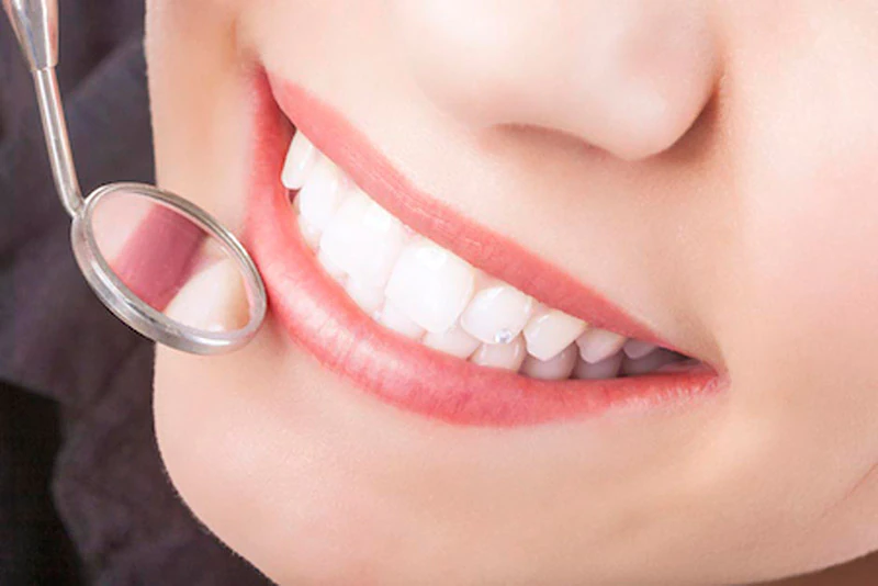 Dental sealants at Radiant Dentistry of Woburn